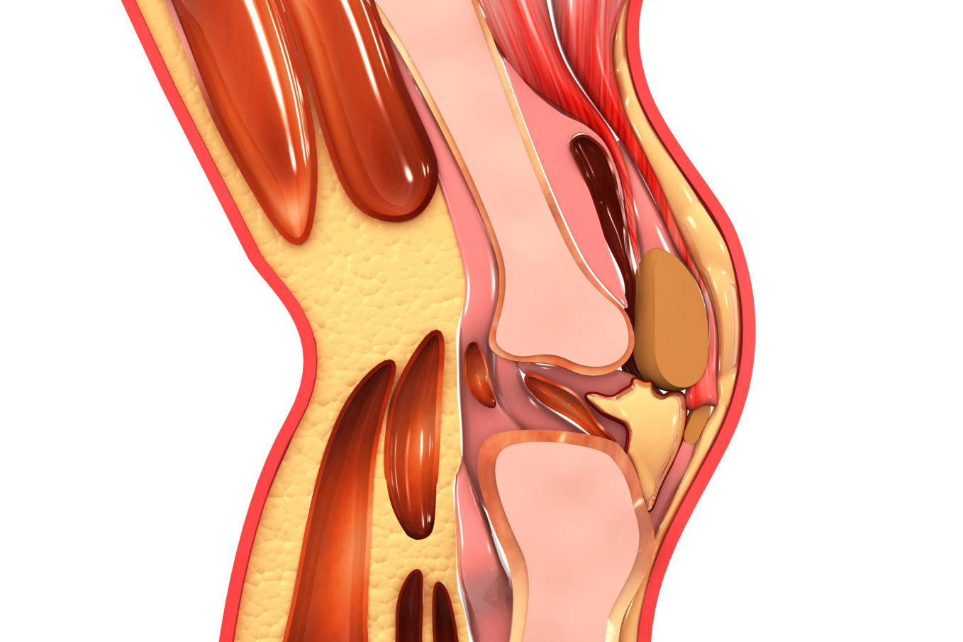 Meine Op Knie Operation Arthroskopisch Klinikguide At Gesundheit